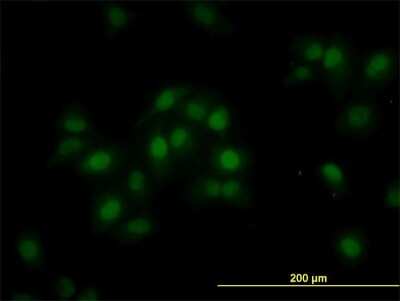 Immunocytochemistry/Immunofluorescence: ORC6L Antibody [H00023594-B01P] - Analysis of purified antibody to ORC6L on HeLa cell. (antibody concentration 10 ug/ml)