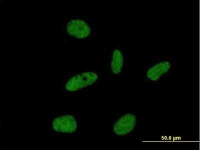 Immunocytochemistry/Immunofluorescence: ORC6L Antibody [H00023594-B02P] - Analysis of purified antibody to ORC6L on HeLa cell. (antibody concentration 10 ug/ml)