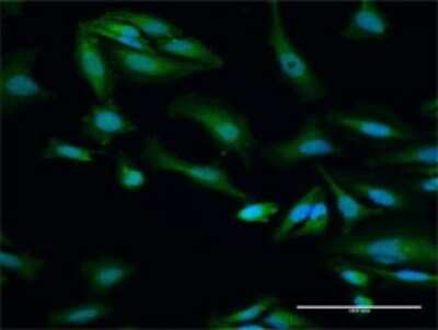 Immunocytochemistry/Immunofluorescence: ORC6L Antibody [H00023594-D01P] - Analysis of antibody to ORC6L on HeLa cell. Antibody concentration 30 ug/ml.