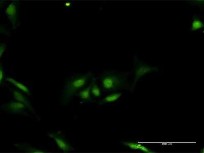 Immunofluorescence: ORC6L Antibody [H00023594-D02P] - Analysis of antibody to ORC6L on HeLa cell. Antibody concentration 20 ug/ml.