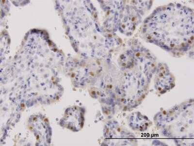 Immunohistochemistry-Paraffin: ORC6L Antibody [H00023594-B01P] - Analysis of purified antibody to ORC6L on formalin-fixed paraffin-embedded human placenta. (antibody concentration 3 ug/ml)