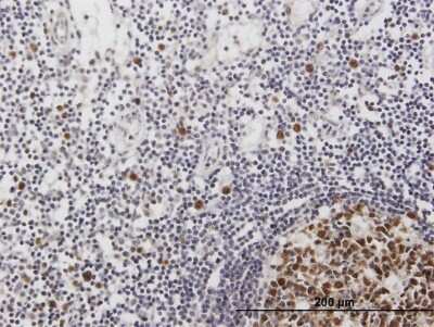 Immunohistochemistry-Paraffin: ORC6L Antibody [H00023594-B02P] - Analysis of purified antibody to ORC6L on formalin-fixed paraffin-embedded human lymph node. (antibody concentration 3 ug/ml)