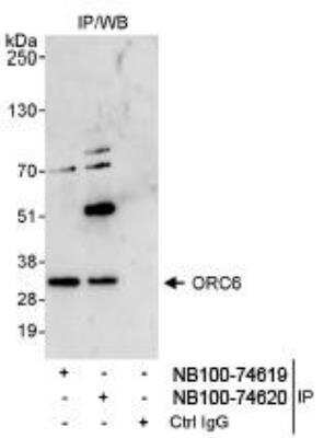 Immunoprecipitation: ORC6L Antibody [NB100-74619] - Detection of Human ORC6 by Western Blot of  Immunoprecipitates. Samples: Whole cell lysate (1 mg for IP,  20% of IP loaded) from HeLa cells. Antibodies: Affinity purified  rabbit anti-ORC6 antibody NB100-74619 used for IP at 3 mcg/mg  lysate. ORC6 was also immunoprecipitated by rabbit anti-ORC6  antibody NB100-74620, which recognizes a downstream epitope.  Detection: Chemiluminescence  with an exposure time of 30 seconds.