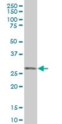 Western Blot: ORC6L Antibody [H00023594-B01P] - Analysis of ORC6L expression in human pancreas.