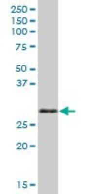Western Blot: ORC6L Antibody [H00023594-B02P] - Analysis of ORC6L expression in human pancreas.