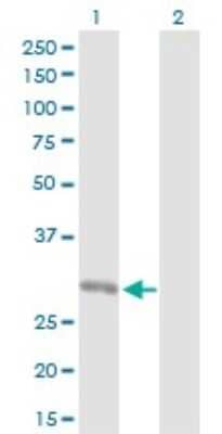 Western Blot: ORC6L Antibody [H00023594-D01P] - Analysis of ORC6L expression in transfected 293T cell line by ORC6L polyclonal antibody.Lane 1: ORC6L transfected lysate(28.10 KDa).Lane 2: Non-transfected lysate.