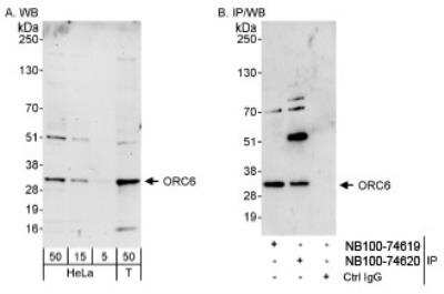 Western Blot: ORC6L Antibody [NB100-74620] - Detection of Human ORC6 on HeLa whole cell lysate using NB100-74620. ORC6 was also immunoprecipitated by rabbit anti-ORC6 antibody NB100-74619.
