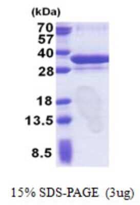 SDS-Page: ORC6L Protein [NBP2-23309]
