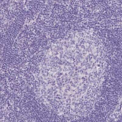 Immunohistochemistry-Paraffin: ORF1 FL49 Antibody [NBP2-13898] - Staining of human lymph node shows low expression as expected.