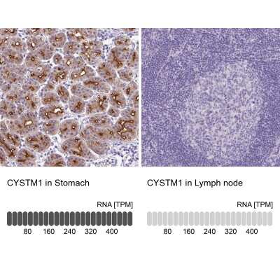 Immunohistochemistry-Paraffin: ORF1 FL49 Antibody [NBP2-13898] - Staining in human stomach and lymph node tissues using anti-CYSTM1 antibody. Corresponding CYSTM1 RNA-seq data are presented for the same tissues.