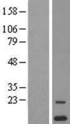 Western Blot: ORF1 FL49 Overexpression Lysate (Adult Normal) [NBP2-06004] Left-Empty vector transfected control cell lysate (HEK293 cell lysate); Right -Over-expression Lysate for ORF1 FL49.