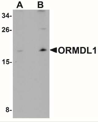 Western Blot ORMDL1 Antibody - BSA Free