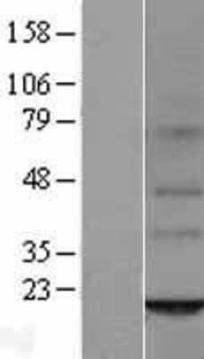 Western Blot ORMDL2 Overexpression Lysate