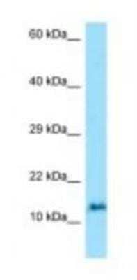 Western Blot ORMDL3 Antibody