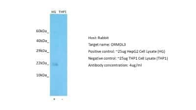 Western Blot ORMDL3 Antibody