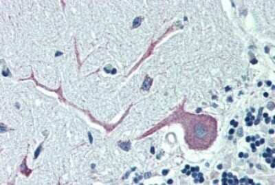 Immunohistochemistry-Paraffin ORP1 Antibody