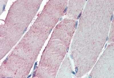 Immunohistochemistry-Paraffin: ORP1 Antibody [NB100-1331] - (5ug/ml) staining of paraffin embedded Human Skeletal Muscle. Steamed antigen retrieval with citrate buffer pH 6, AP-staining.