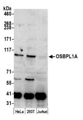 Western Blot: ORP1 Antibody [NBP2-59119] - Detection of human OSBPL1A by western blot. Samples: Whole cell lysate (50 ug) from HeLa, 293T, and Jurkat cells prepared using NETN lysis buffer. Antibody: Affinity purified rabbit anti-OSBPL1A antibody NBP2-59119 used for WB at 1:1000. Detection: Chemiluminescence with an exposure time of 3 minutes.