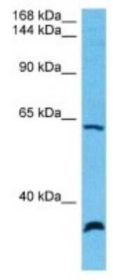 Western Blot: ORP1 Antibody [NBP3-10055] - Western blot analysis of ORP1 in Human Mesenchymoma Tumor lysates. Antibody dilution at 1ug/ml