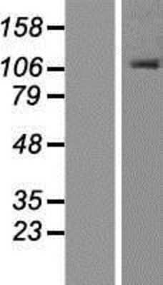 Western Blot: ORP1 Overexpression Lysate (Adult Normal) [NBP2-05778] Left-Empty vector transfected control cell lysate (HEK293 cell lysate); Right -Over-expression Lysate for ORP1.