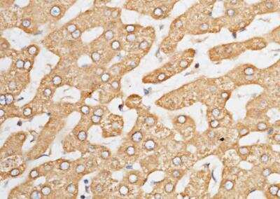 Immunohistochemistry-Paraffin: ORP150/HSP12A Antibody (201) [NBP2-89890] - Staining of human HSP12A in human cirrhosis with rabbit monoclonal antibody (1:200).