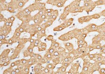 Immunohistochemistry-Paraffin: ORP150/HSP12A Antibody (201) [NBP2-89890] - Staining of human HSP12A in human cirrhosis with rabbit monoclonal antibody (1:200).