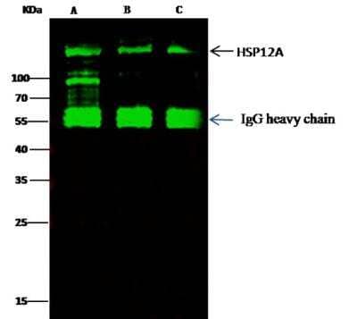 Immunoprecipitation: ORP150/HSP12A Antibody (201) [NBP2-89890] - Lane A:0.5 mg MCF-7 Whole Cell Lysate Lane B:0.5 mg 293T Whole Cell LysateLane C:0.5 mg Hela Whole Cell Lysate 2 uL anti-HSP12A rabbit monoclonal antibody and 15 ul of 50 % Protein G agarose. Primary antibody:Anti-HSP12A rabbit monoclonal antibody,at 1:100 dilution Secondary antibody:Dylight 800-labeled antibody to rabbit IgG (H+L), at 1:5000 dilution Developed using the odssey technique. Performed under reducing conditions.Predicted band size: 111 kDaObserved band size: 111 kDa