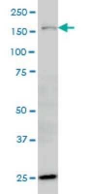 Western Blot ORP150/HSP12A Antibody (6F7) - Azide and BSA Free
