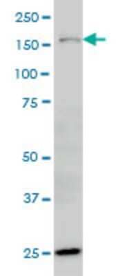 Western Blot: ORP150/HSP12A Antibody (6F7) [H00010525-M01] - HYOU1 monoclonal antibody (M01), clone 6F7 Analysis of HYOU1 expression in MCF-7.