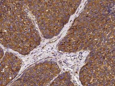 Immunohistochemistry-Paraffin: ORP150/HSP12A Antibody [NBP2-99781] - Immunochemical staining of human ORP150/HSP12A in human liver with rabbit polyclonal antibody (1:5000, formalin-fixed paraffin embedded sections).