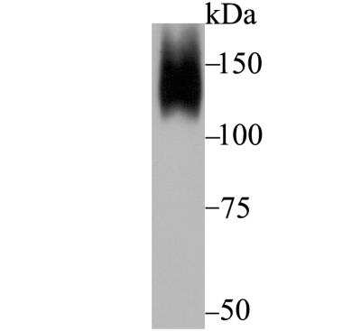 Western Blot: ORP150/HSP12A Antibody (JG39-11) [NBP2-76858] - Western blot analysis of ORP150 on mouse prostate tissue lysate using anti-ORP150 antibody at 1/5,000 dilution.