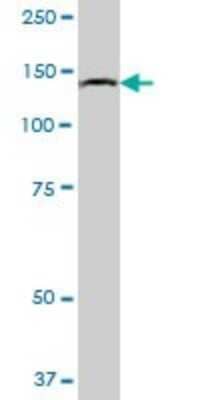 Western Blot: ORP150/HSP12A Antibody [H00010525-B01P] - Analysis of HYOU1 expression in human liver.