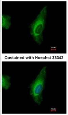 Immunocytochemistry/ Immunofluorescence ORP8 Antibody