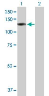 Western Blot: ORP8 Antibody [H00114882-B01P] - Analysis of OSBPL8 expression in transfected 293T cell line by OSBPL8 polyclonal antibody.  Lane 1: OSBPL8 transfected lysate(93.17 KDa). Lane 2: Non-transfected lysate.