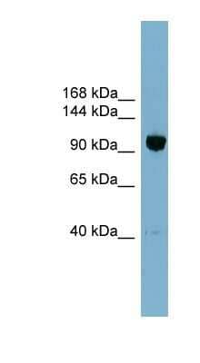 Western Blot: ORP8 Antibody [NBP1-59815] - OVCAR-3 cell lysate, concentration 0.2-1 ug/ml.