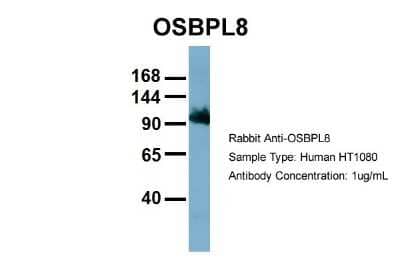Western Blot: ORP8 Antibody [NBP1-59815] - HT1080, Antibody Dilution: 1.0 ug/ml OSBPL8 is strongly supported by BioGPS gene expression data to be expressed in Human HT1080 cells.