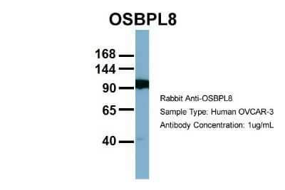 Western Blot: ORP8 Antibody [NBP1-59815] - OVCAR-3, Antibody Dilution: 1.0 ug/ml OSBPL8 is strongly supported by BioGPS gene expression data to be expressed in OVCAR3.