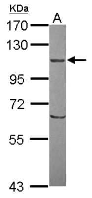 Western Blot ORP8 Antibody