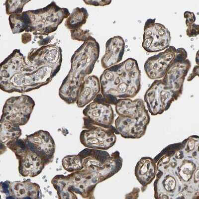 Immunohistochemistry-Paraffin: OS9 Antibody [NBP1-84803] - Staining of human placenta shows cytoplasmic positivity in trophoblastic cells.