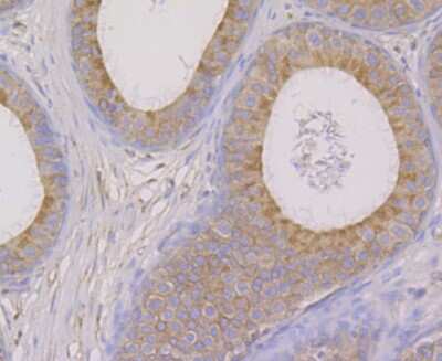 Immunohistochemistry-Paraffin: OS9 Antibody (JG38-07) [NBP2-75602] - Analysis of paraffin-embedded rat epididymis tissue using anti-OS9 antibody. Counter stained with hematoxylin.