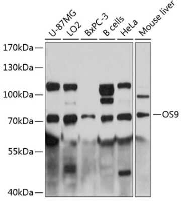 Western Blot: OS9 Antibody [NBP2-93962] - Analysis of extracts of various cell lines, using OS9 at 1:3000 dilution.Secondary antibody: HRP Goat Anti-Rabbit IgG (H+L) at 1:10000 dilution.Lysates/proteins: 25ug per lane.Blocking buffer: 3% nonfat dry milk in TBST.Detection: ECL Basic Kit .Exposure time: 15s.