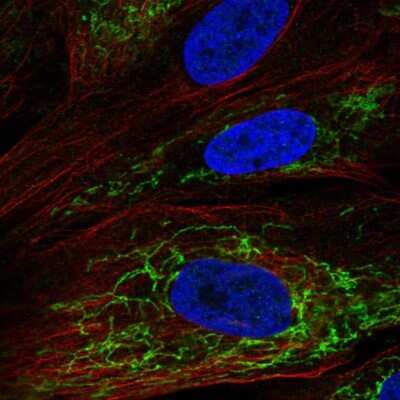 Immunocytochemistry/Immunofluorescence: OSAP Antibody [NBP2-54955] - Staining of human cell line BJ shows localization to mitochondria.