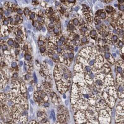 Immunohistochemistry-Paraffin OSAP Antibody