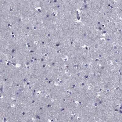 Immunohistochemistry-Paraffin: OSAP Antibody [NBP3-17084] - Staining of human cerebral cortex shows low expression as expected.