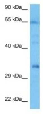 Western Blot: OSAP Antibody [NBP3-10151] - Western blot analysis of OSAP in Mouse Small Intestine lysates. Antibody dilution at 1ug/ml