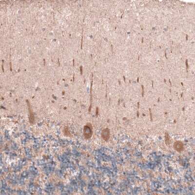 Immunohistochemistry-Paraffin OSBP2 Antibody