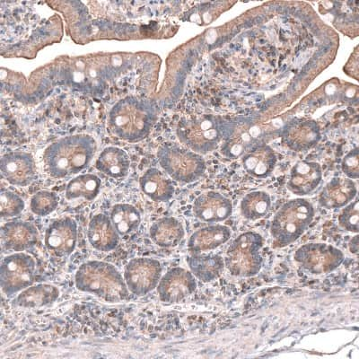 Immunohistochemistry-Paraffin OSBP2 Antibody