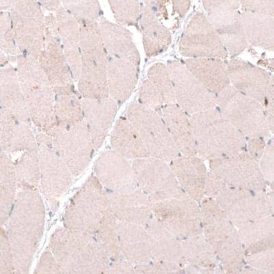 Immunohistochemistry-Paraffin OSBP2 Antibody