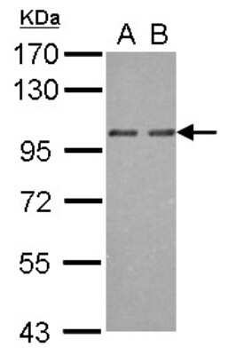 Western Blot: OSBP2 Antibody [NBP2-19635] - Sample (30 ug of whole cell lysate) A: NT2D1 B: IMR32 7. 5% SDS PAGE gel, diluted at 1:1000.