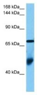 Western Blot: OSBP2 Antibody [NBP3-10082] - Western blot analysis of OSBP2 in Human Leiomyosarcoma Tumor lysates. Antibody dilution at 1ug/ml